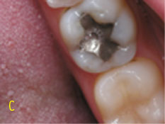 cinescope white after affects cinescope white after affects