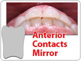 PhotoMed Anterior Contacts Mirror